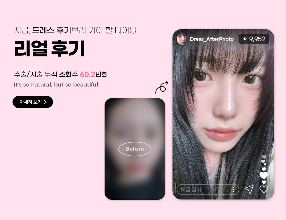 Dress Phẫu thuật thẩm mỹ - 사진 1